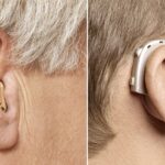 Audífono Retroauricular: Tecnología y Comodidad en la Audición