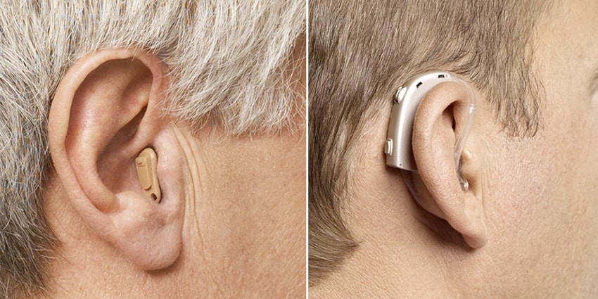 Audífono Retroauricular: Tecnología y Comodidad en la Audición